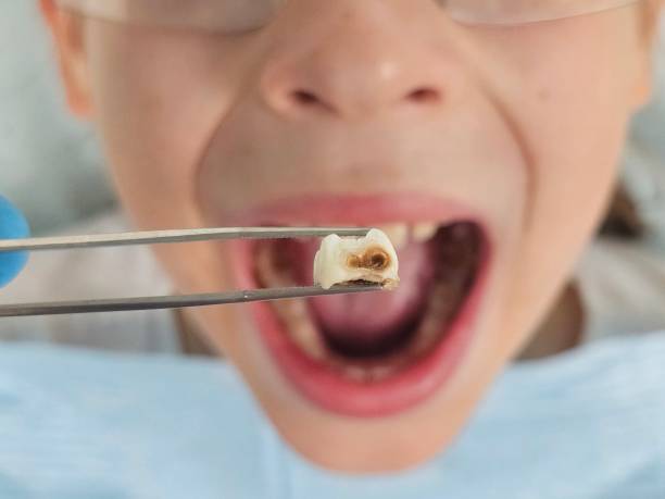 Best Mobile Emergency Dentist in St Simons, GA